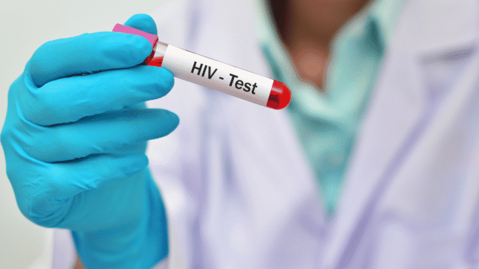 hiv testing hiv testing
